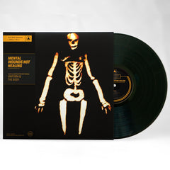 Mental Wounds Not Healing